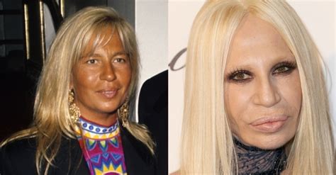 donatella versace antes e depois|donatella versace 2023.